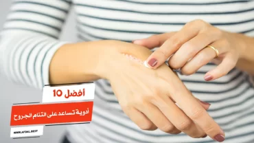 أفضل 10 أدوية تساعد على التئام الجروح