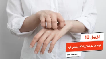 أفضل 10 أنواع كريم لعلاج الأكزيما في اليد