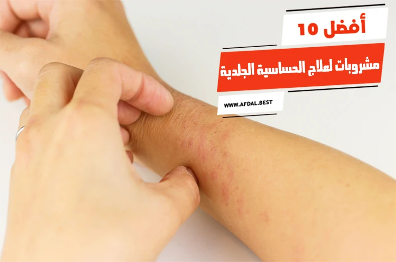 أفضل 10 مشروبات لعلاج الحساسية الجلدية